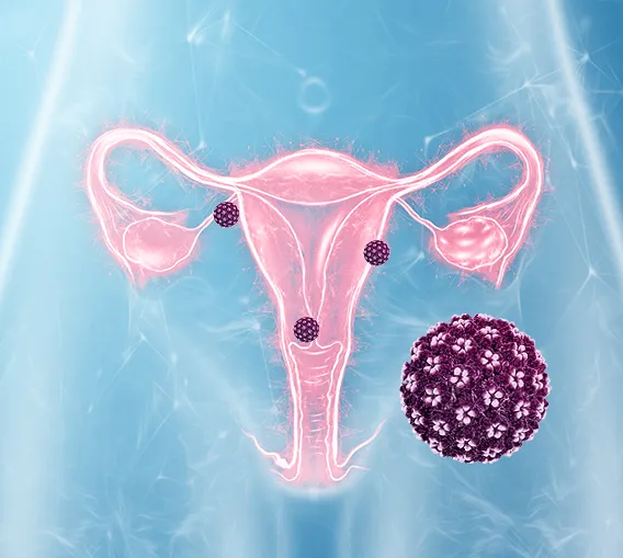 Spontánní HPV clearance